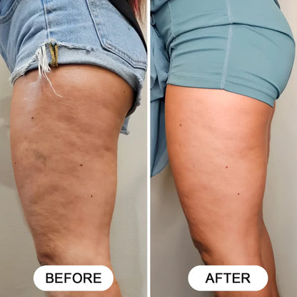 CompleteCore™️ Anti-Cellulite Massager